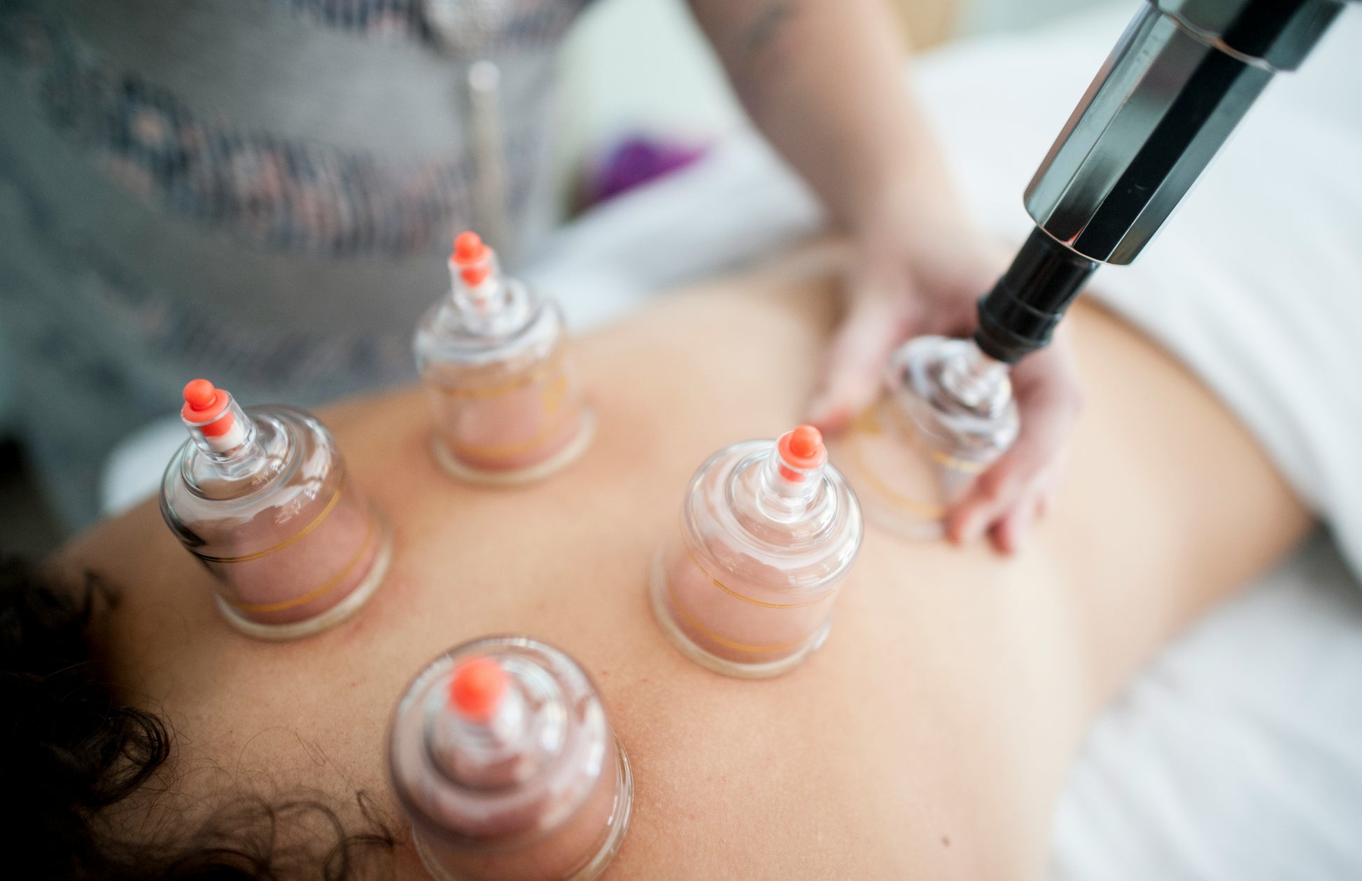 Dynamic Cupping Massage therapy for chronic pain relief, Gentle cupping technique to improve blood circulation, Deep tissue cupping massage to release adhesions, Cupping massage for increased range of motion, Therapeutic Dynamic Cupping Massage for muscle healing